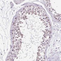 Anti-TEX15 antibody produced in rabbit 