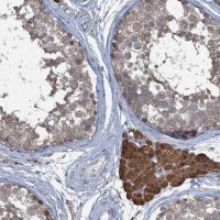 Anti-TEX35 antibody produced in rabbit 