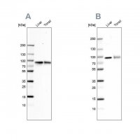 Anti-TF antibody produced in rabbit 