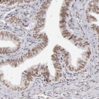 Anti-TFAP4 antibody produced in rabbit 