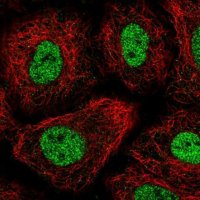 Anti-TGIF1 antibody produced in rabbit HPA062160-100UL