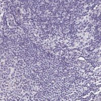 Anti-TGM3 antibody produced in rabbit HPA004728-100UL