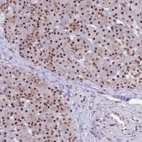 Anti-THOC2 antibody produced in rabbit 