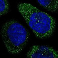 Anti-THSD1 antibody produced in rabbit 