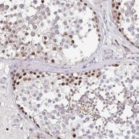 Anti-TIMELESS antibody produced in rabbit 