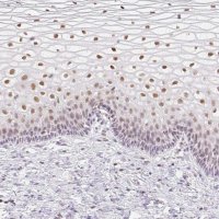 Anti-TLE3 antibody produced in rabbit 