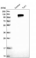Anti-TLK1 antibody produced in rabbit 