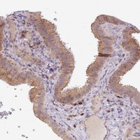 Anti-TM2D2 antibody produced in rabbit 
