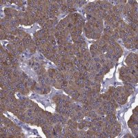 Anti-TMC3 antibody produced in rabbit 