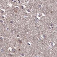Anti-TMC5 antibody produced in rabbit 