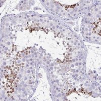 Anti-TMCO5A antibody produced in rabbit 