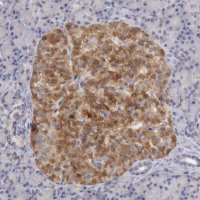 Anti-TMED8 antibody produced in rabbit 