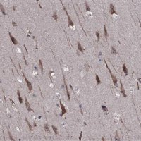 Anti-TMEM151A antibody produced in rabbit HPA041035-100UL