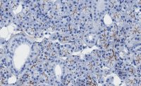 Anti-TMEM16A Antibody, clone 3J18, ZooMAb Rabbit Monoclonal 
