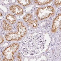 Anti-TMEM174 antibody produced in rabbit 