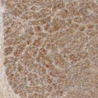 Anti-TMEM192 antibody produced in rabbit 