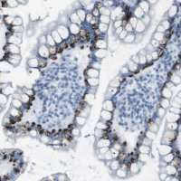 Anti-TMEM207 antibody produced in rabbit HPA014332-100UL