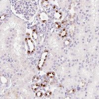 Anti-TMEM213 antibody produced in rabbit 