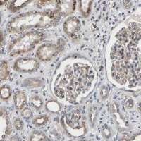 Anti-TMEM38B antibody produced in rabbit HPA018465-100UL