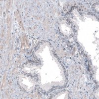 Anti-TMEM43 antibody produced in rabbit 