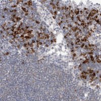 Anti-TMEM69 antibody produced in rabbit HPA026993-100UL