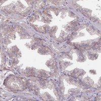 Anti-TMEM88 antibody produced in rabbit 