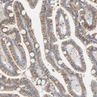 Anti-TMIGD2 antibody produced in rabbit 