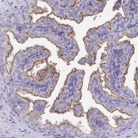 Anti-TMPRSS2 antibody produced in rabbit 