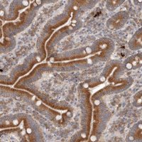 Anti-TMUB1 antibody produced in rabbit 