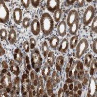 Anti-TMX3 antibody produced in rabbit HPA014157-100UL
