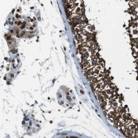 Anti-TMX4 antibody produced in rabbit HPA015752-100UL