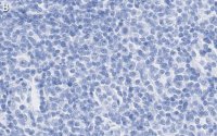 Anti-TNF/LTA Antibody, clone 3B20-H2 ZooMAb Rabbit Monoclonal 