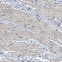 Anti-TNFAIP1 antibody produced in rabbit HPA014641-100UL