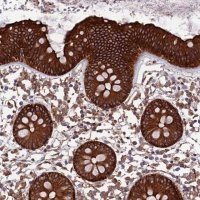 Anti-TNIP3 antibody produced in rabbit HPA043063-100UL