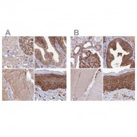 Anti-TNKS1BP1 antibody produced in rabbit 