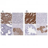 Anti-TNNC1 antibody produced in rabbit 