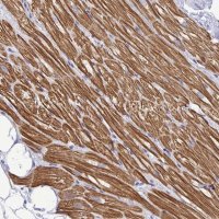 Anti-TNNI3 antibody produced in rabbit 