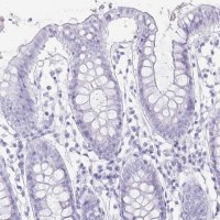 Anti-TNNT1 antibody produced in rabbit 