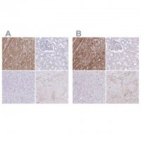 Anti-TNNT2 antibody produced in rabbit 