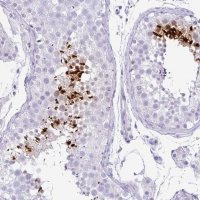 Anti-TNP1 antibody produced in rabbit 