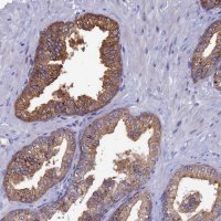 Anti-TOMM20L antibody produced in rabbit 