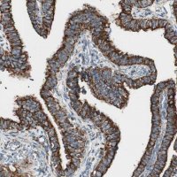Anti-TOMM22 antibody produced in rabbit 