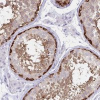 Anti-TOMM34 antibody produced in rabbit HPA056875-100UL