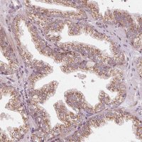 Anti-TOMM70 antibody produced in rabbit 