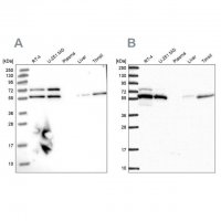 Anti-TOR1AIP1 antibody produced in rabbit 