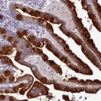 Anti-TOR1AIP2 antibody produced in rabbit 
