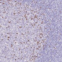 Anti-TOX2 antibody produced in rabbit 