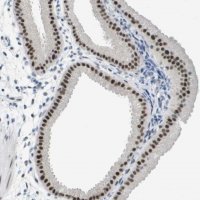 Anti-TP53RK antibody produced in rabbit HPA015837-100UL