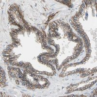 Anti-TPBG antibody produced in rabbit HPA010554-100UL