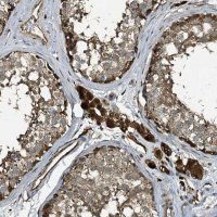 Anti-TPGS2 antibody produced in rabbit 